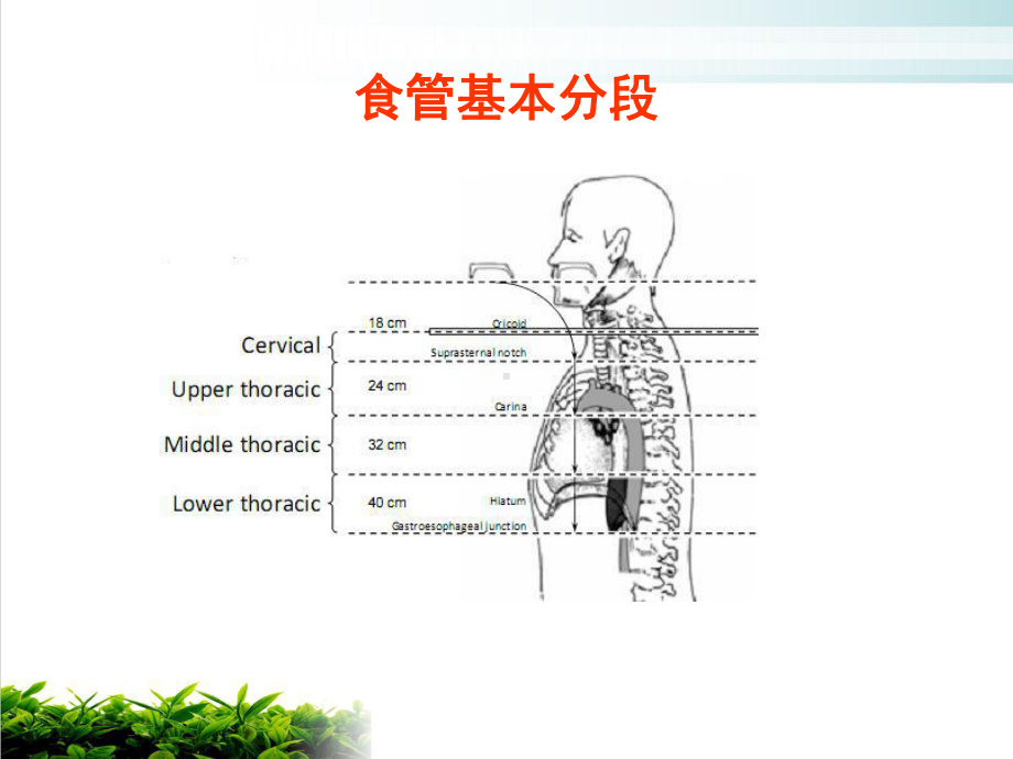 食管癌精确放射治疗靶区认识石家庄课件.pptx_第1页