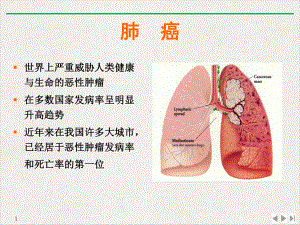 非小细胞肺癌的常用化疗方案实用版课件.pptx