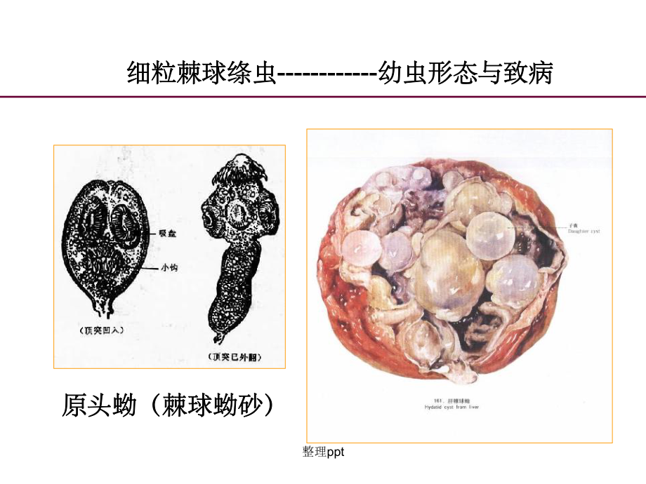 《棘球绦虫临床》课件.ppt_第3页