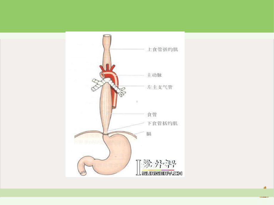 食道癌护理查房剖析课件.pptx_第3页