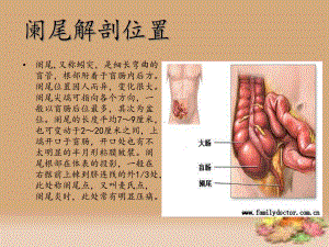 阑尾切除术的手术配合PPT课件.pptx