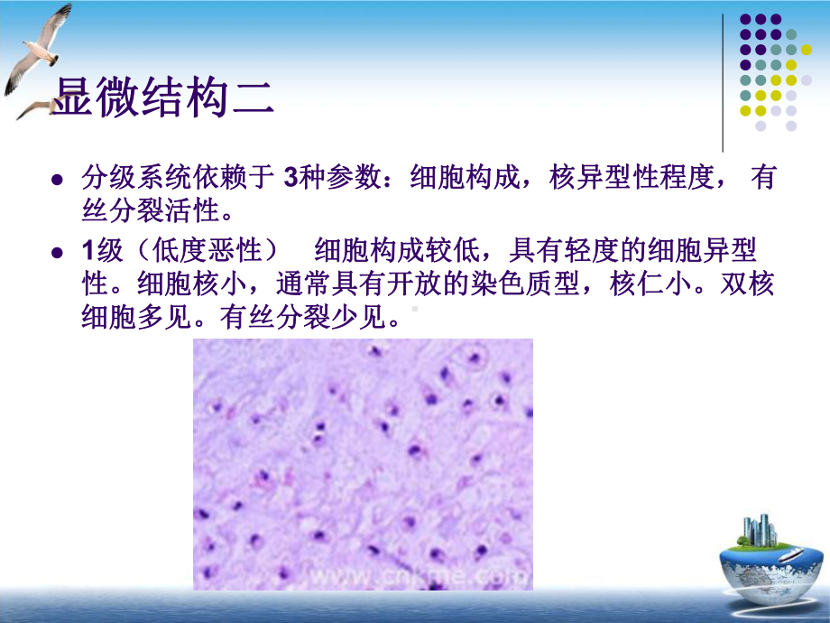 软骨肉瘤的病理及影像学表现课件.pptx_第3页