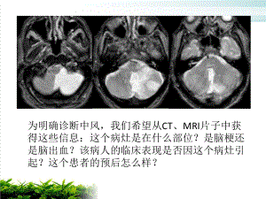 颅脑解剖课件整理.pptx