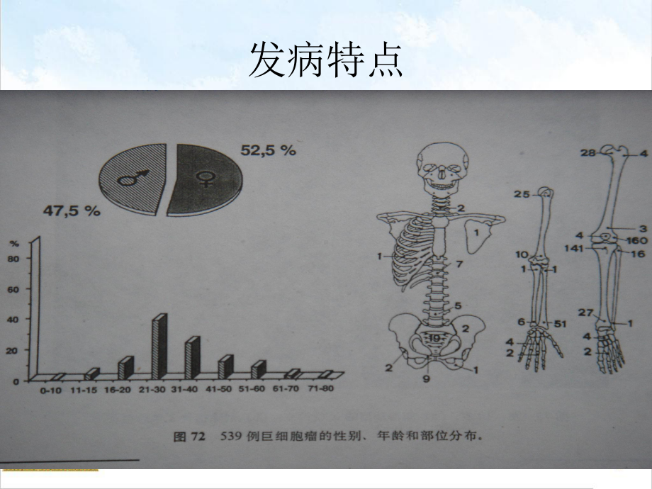 骨巨细胞瘤兰大课件.pptx_第3页