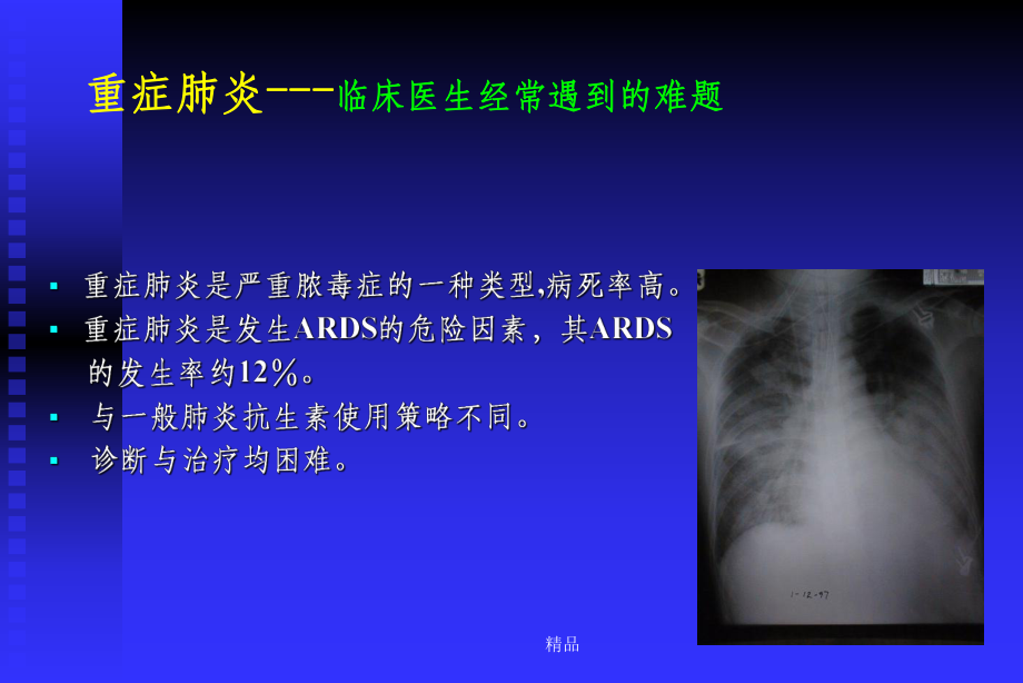 重症肺炎抗生素选择原则课件.ppt_第3页