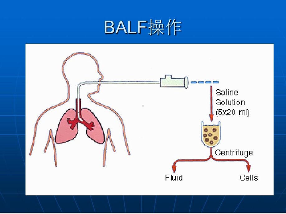 支气管肺泡灌洗和透壁肺活检课件.ppt_第2页