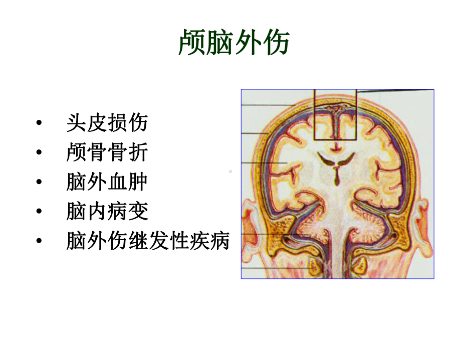 颅脑外伤的急诊CT诊断课件.ppt_第2页