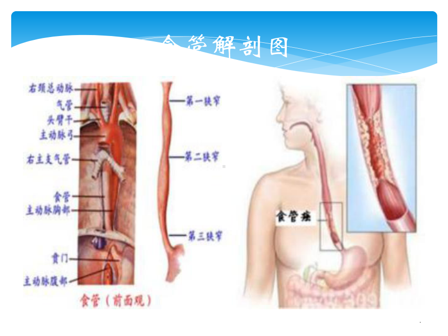 食管与胃疾病课件.ppt_第2页