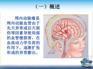 颅内动脉瘤疾病查房课件.pptx