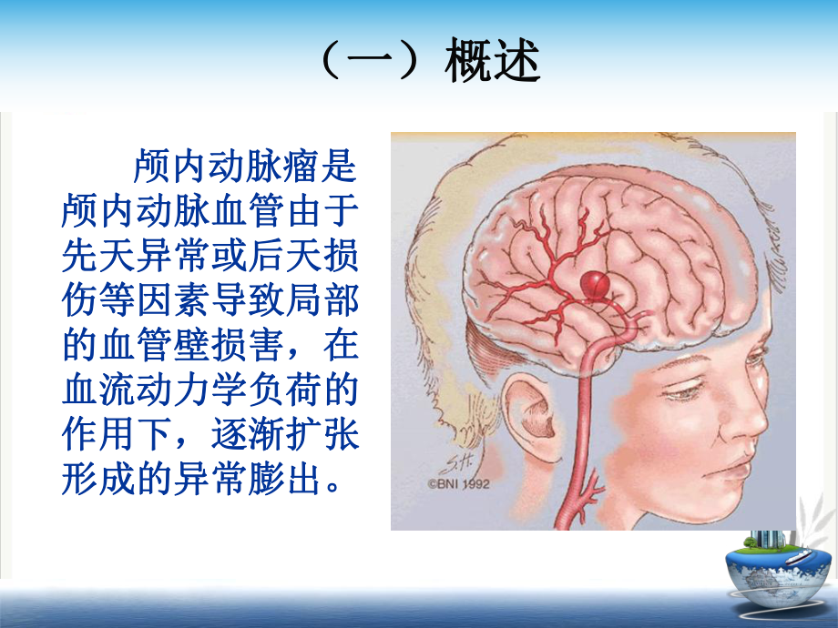 颅内动脉瘤疾病查房课件.pptx_第1页