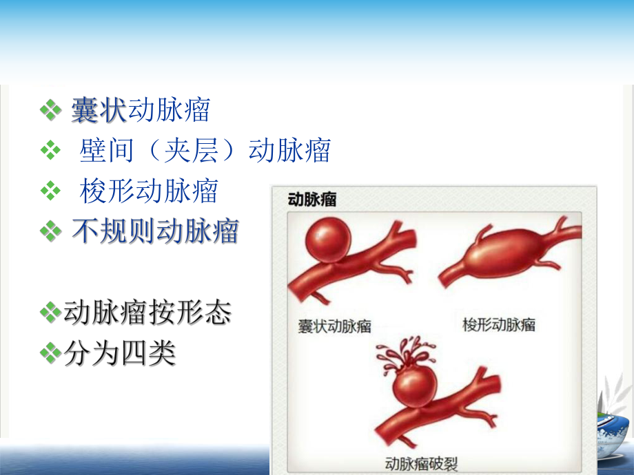 颅内动脉瘤疾病查房课件.pptx_第3页