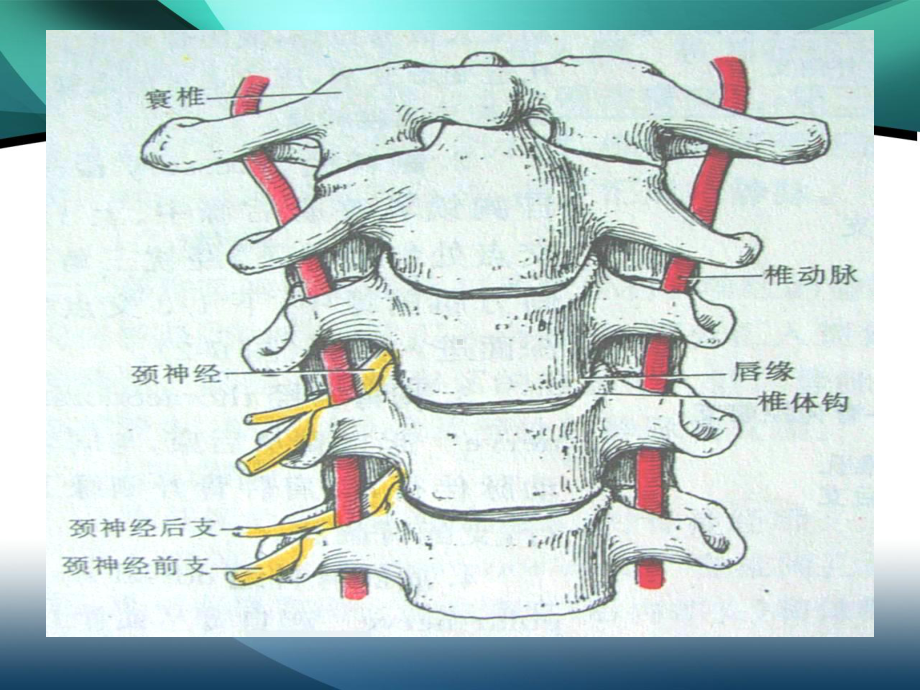 颈椎病-教学讲解课件.ppt_第3页