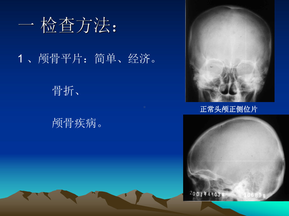 颅脑影像学检查新版课件.pptx_第3页