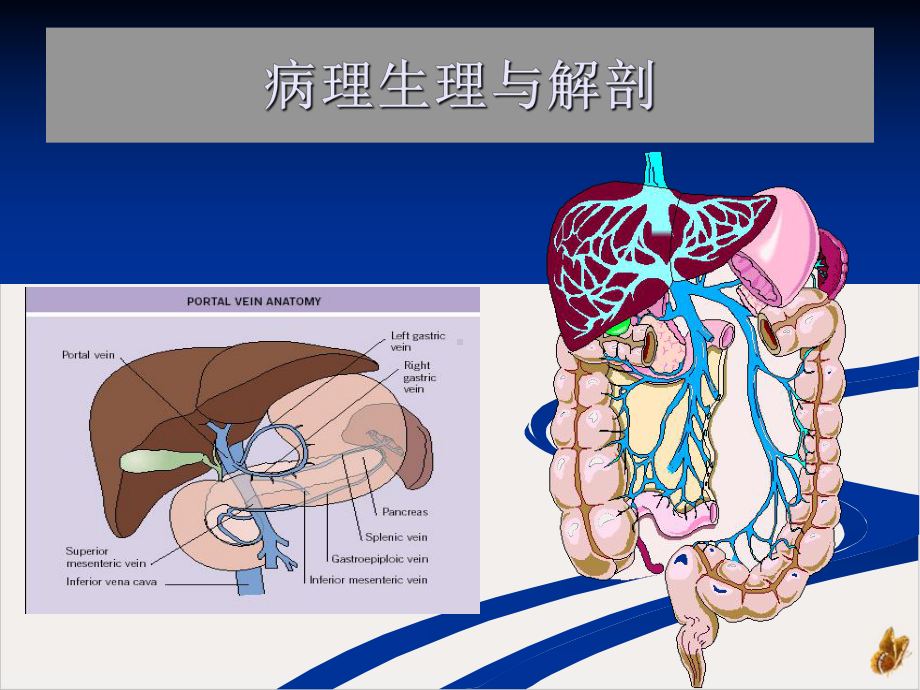 门静脉高压症Portalhypertension课件.pptx_第3页