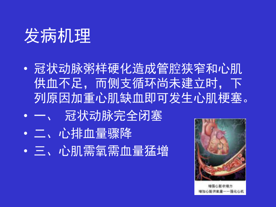 急性心肌梗塞及护理知识课件.ppt_第3页