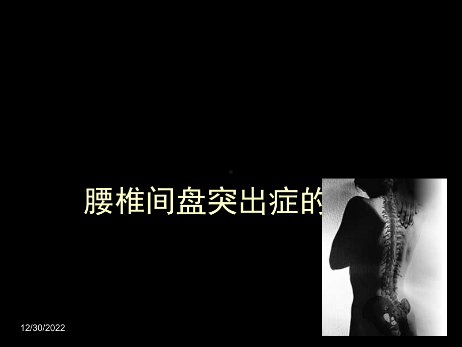 椎间盘突出症CT表现课件.ppt_第1页