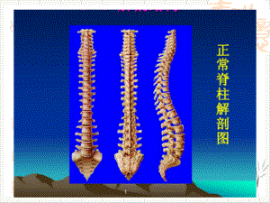 颈肩腰腿痛的康复治疗—运动与误区课件.pptx