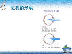 近视眼的防治课件.pptx