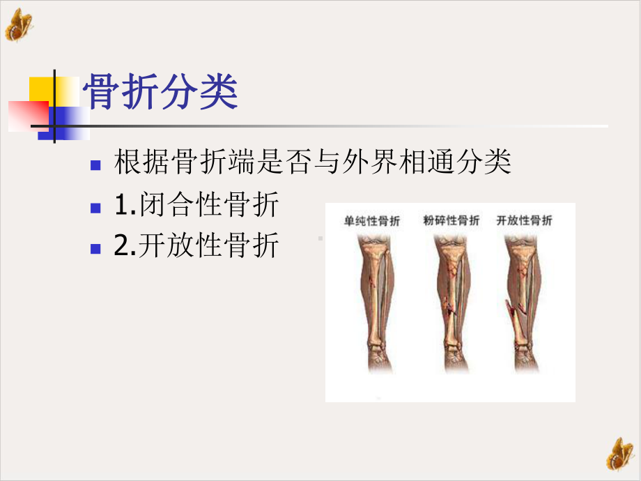 骨折病人护理课件.pptx_第3页