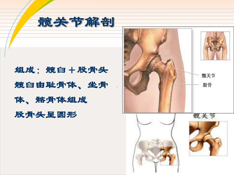 髋关节置换护理课件.pptx_第3页