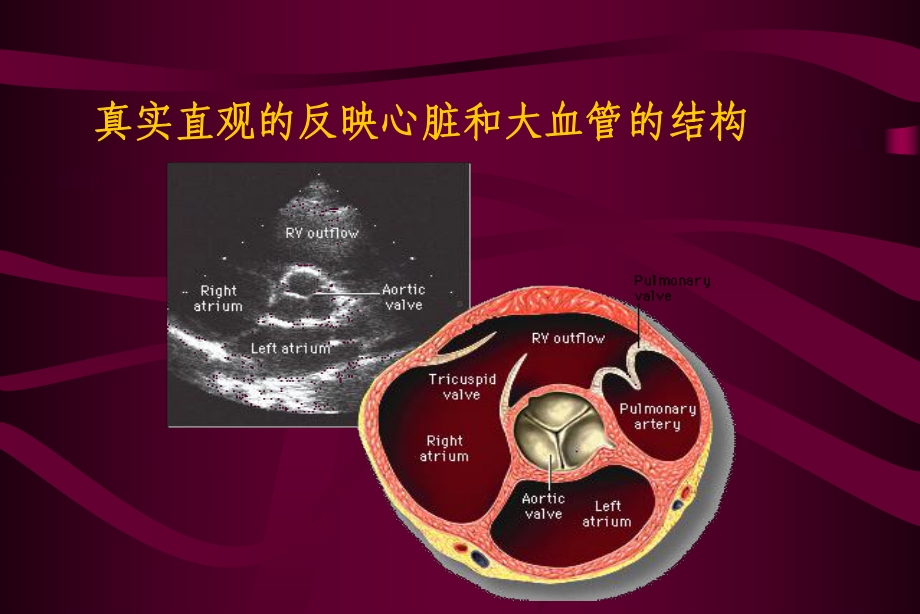 超声心动图在先天性心脏病诊疗中的应用课件.ppt_第3页