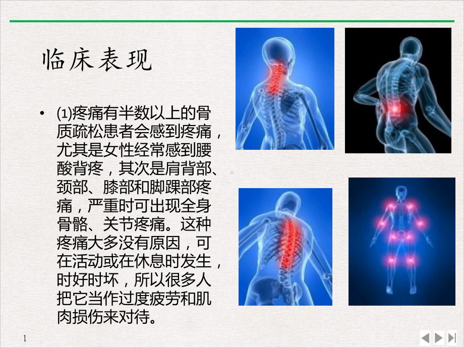 骨质疏松健康教育讲座完美课课件.pptx_第2页