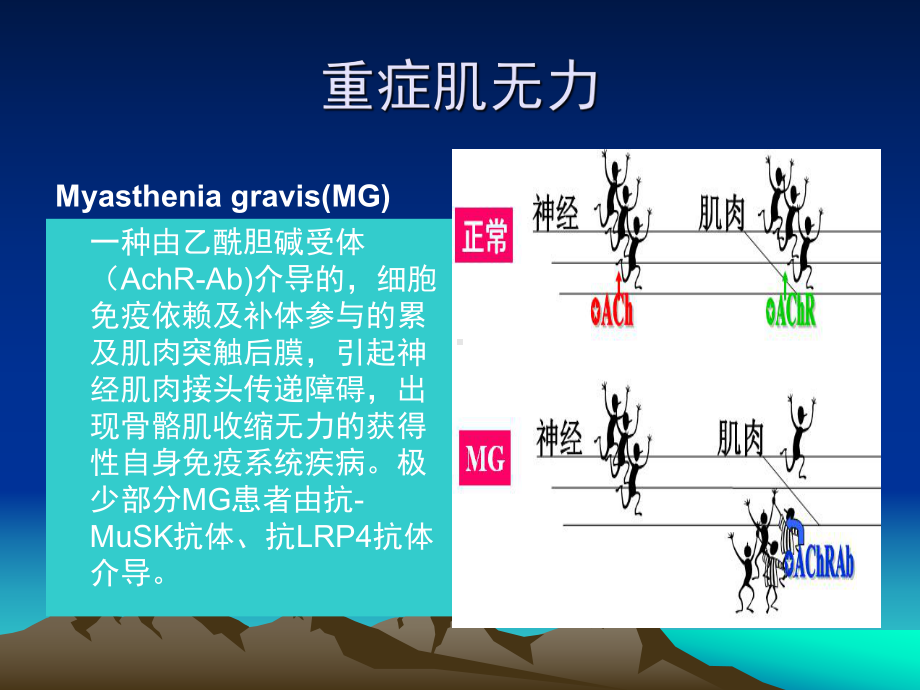 重症肌无力个案课件.pptx_第2页