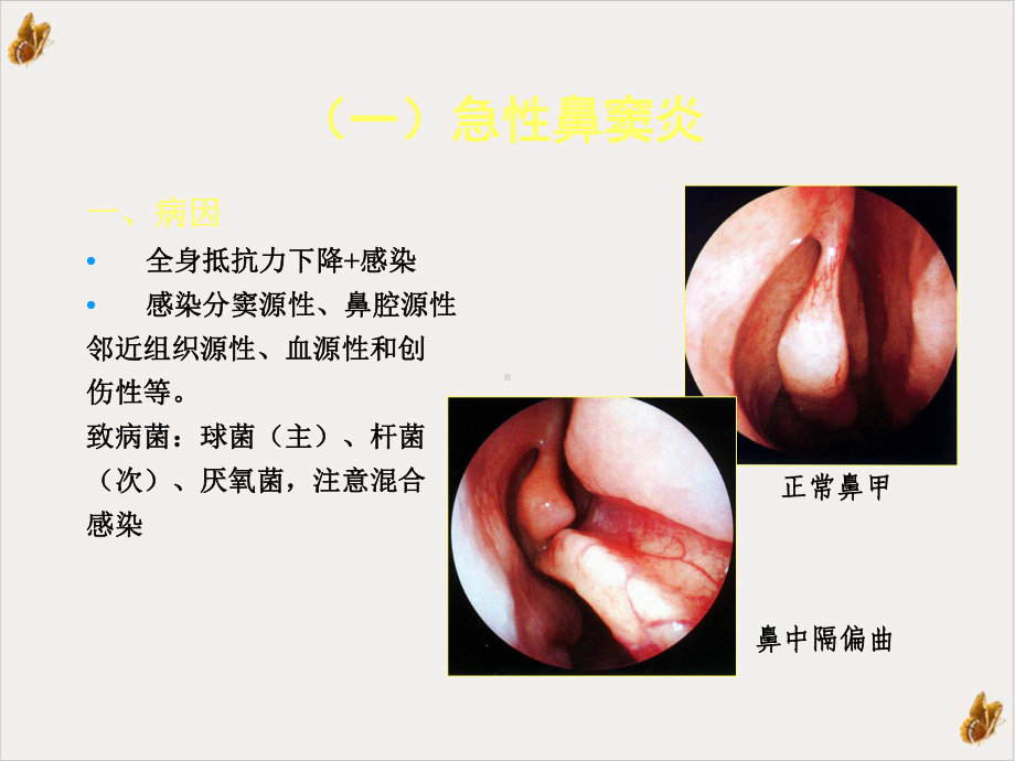 鼻窦炎的食疗验方课件.pptx_第3页