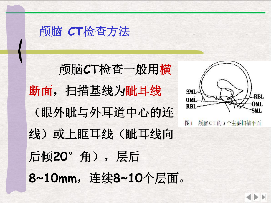 颅脑断面解剖完美版课件.pptx_第2页