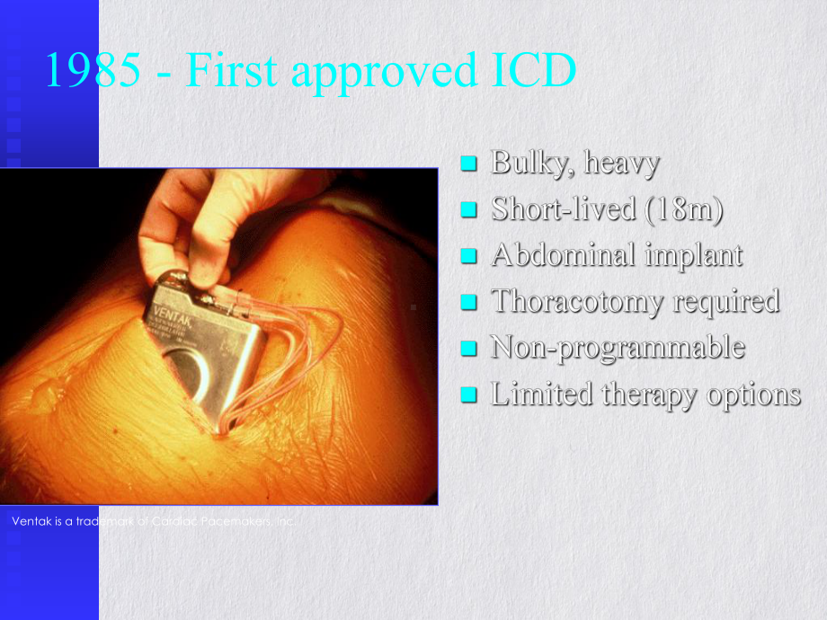 除颤起搏器的临床应用ppt课件.pptx_第3页