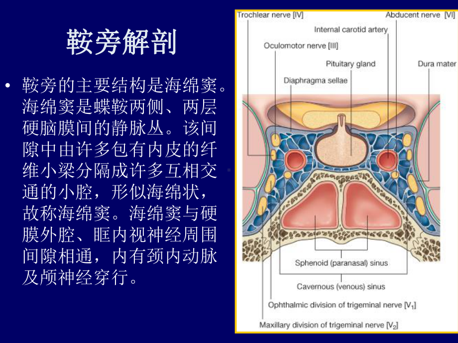 鞍旁肿瘤MR诊断及鉴别诊断课件.ppt_第2页