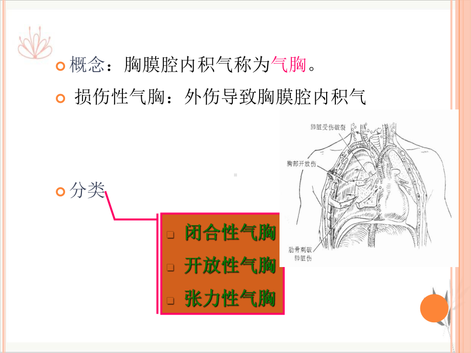 气胸血气胸脓胸护理常规-课件.pptx_第2页