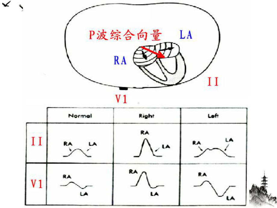 诊断学心电图讲课系列课件.ppt_第3页