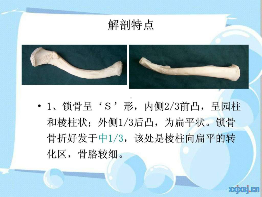 锁骨骨折护理查房课件-2.ppt_第2页