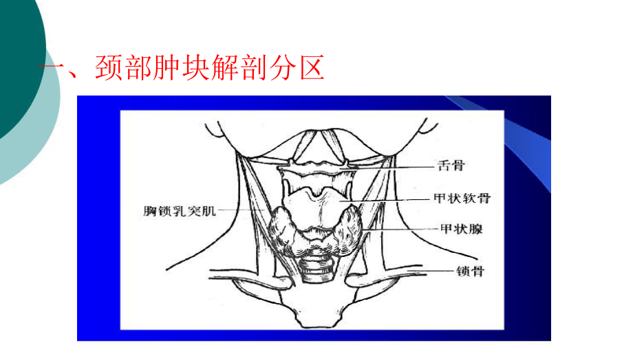 颈部肿块的诊断和鉴别诊断-课件2.ppt_第3页