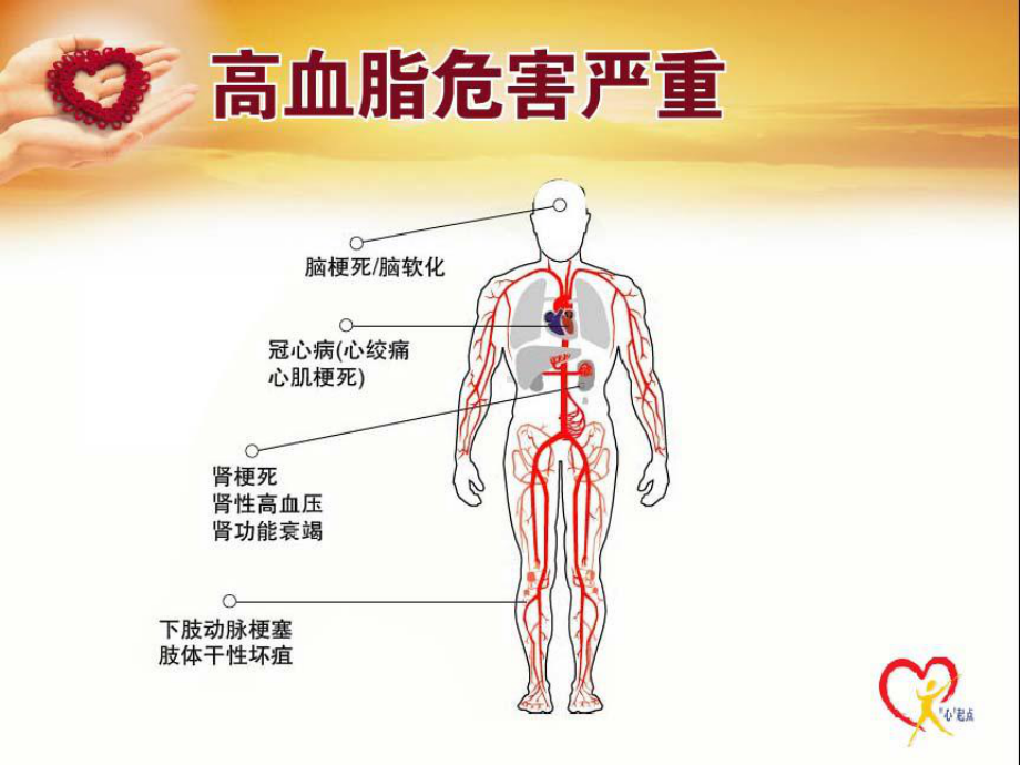 高血脂危害课件.ppt_第2页