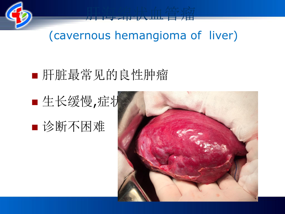 其他肝脏肿瘤及肝脏疾病诊治进展课件.pptx_第3页