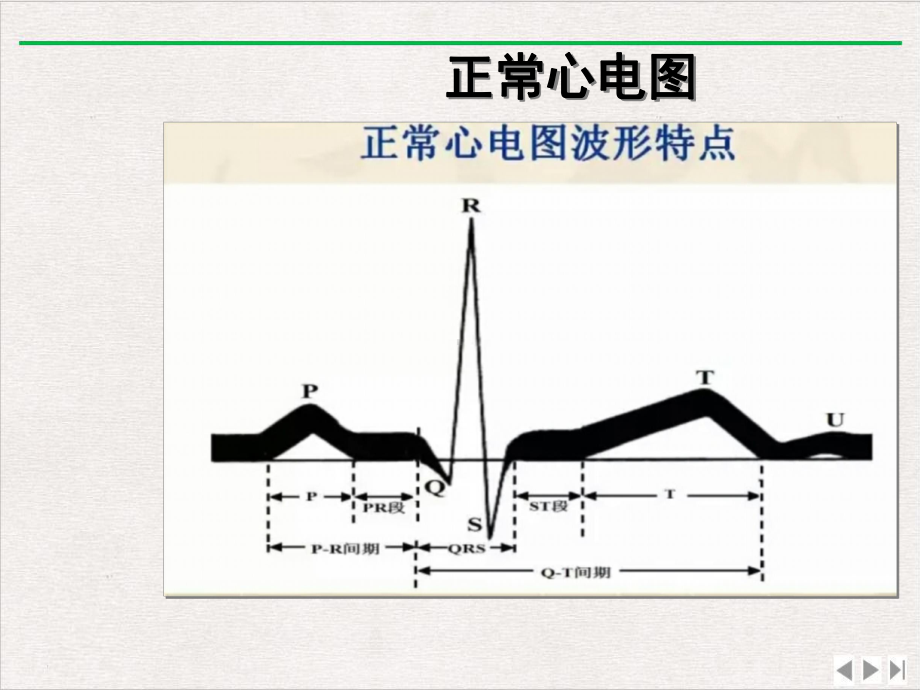 麻醉手术中常见心率失常实用版课件.ppt_第3页