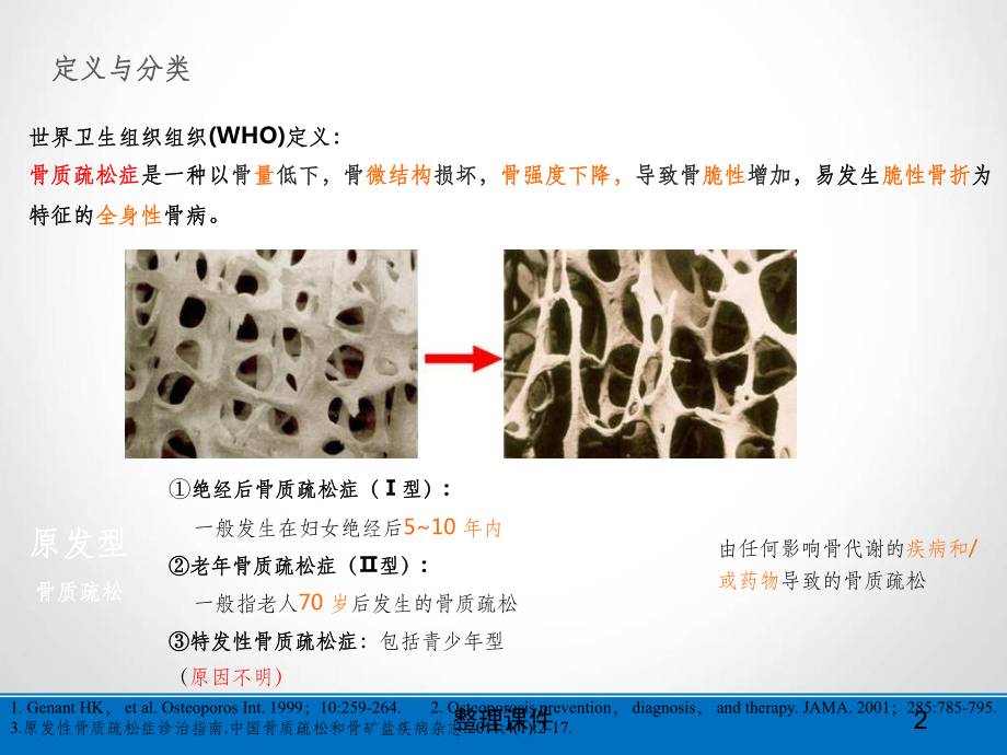 骨质疏松压缩性骨折的治疗课件.ppt_第2页