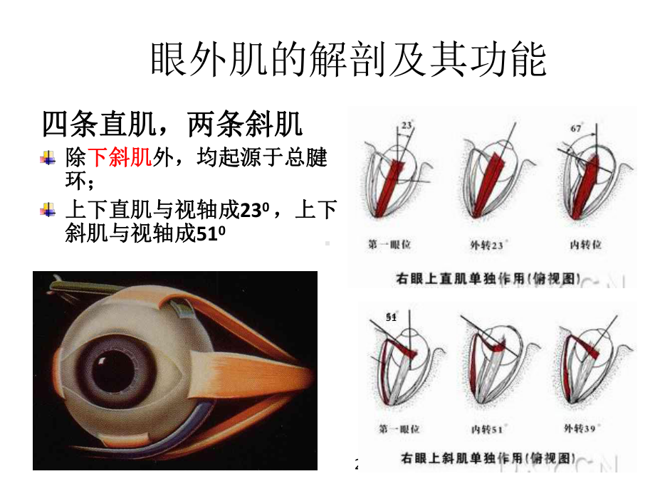 斜视与弱视整理课件.ppt_第2页