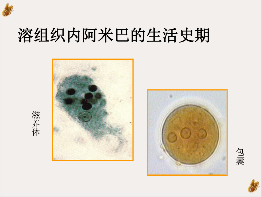 阿米巴病寄生虫学培训课程课件.ppt_第3页