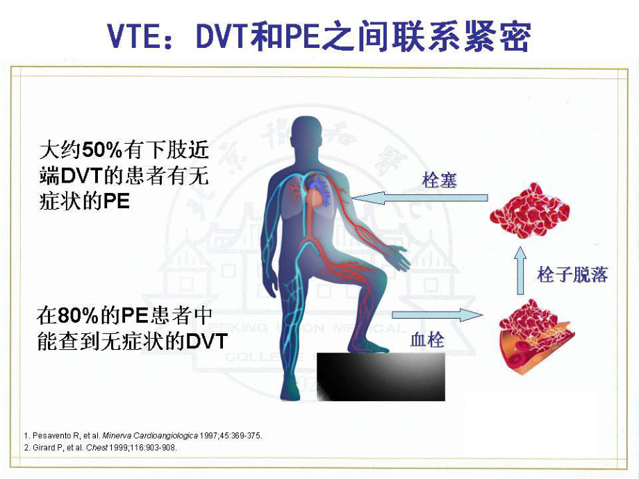 静脉血栓症的实验室诊断课件.pptx_第2页