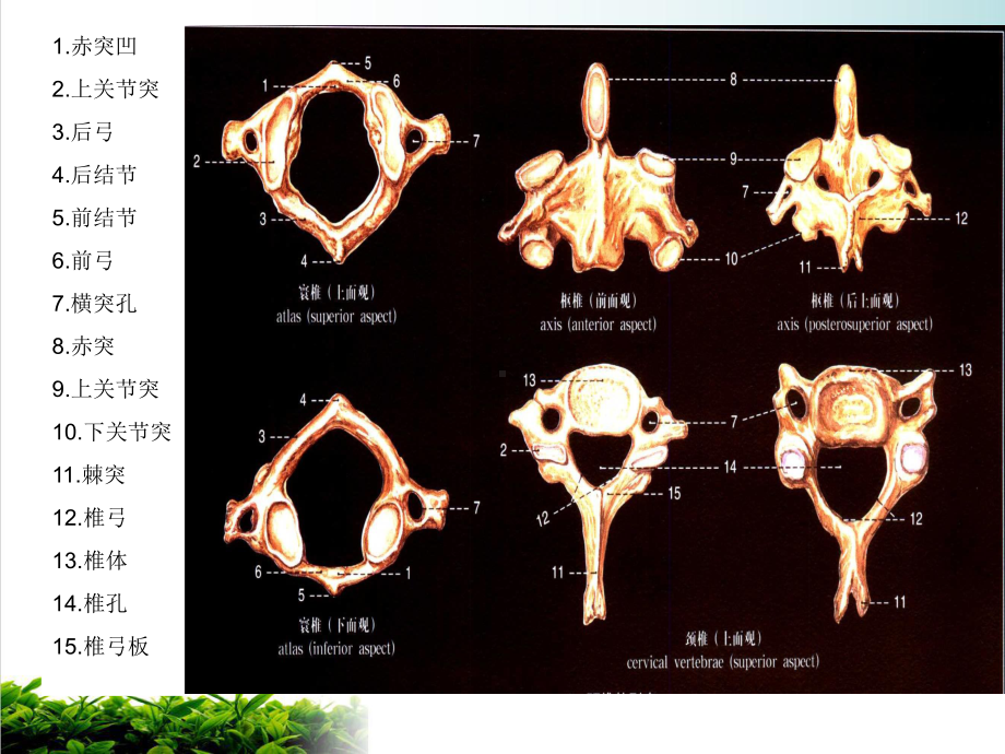 颈椎X线诊断课件(模板).ppt_第3页