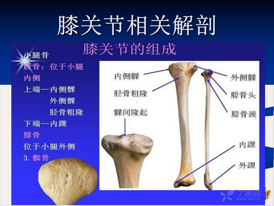 骨性关节炎课件.pptx_第3页