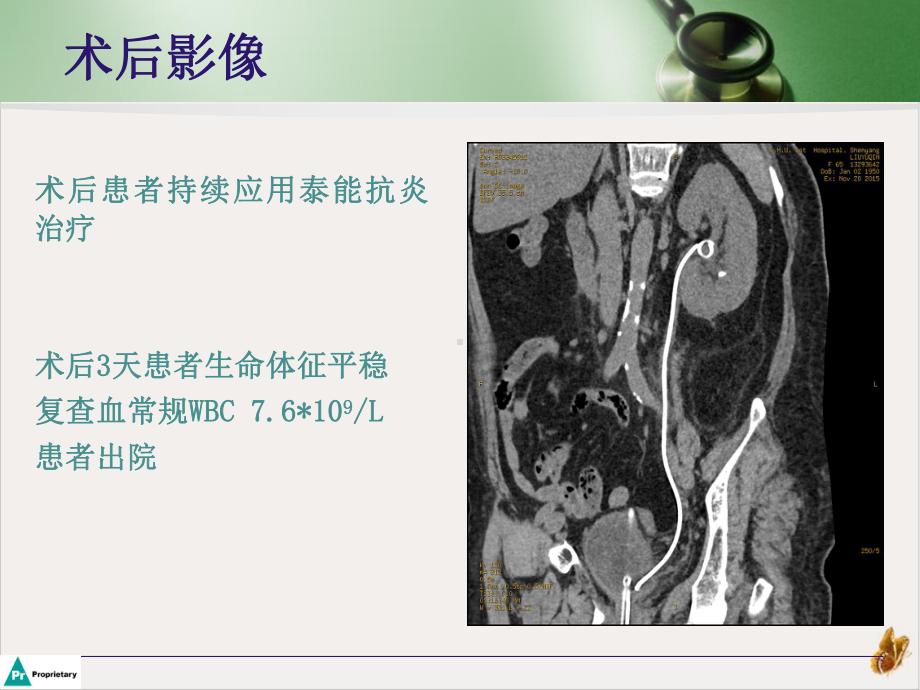 泌尿系统结石抗感染治疗策略课件.pptx_第3页