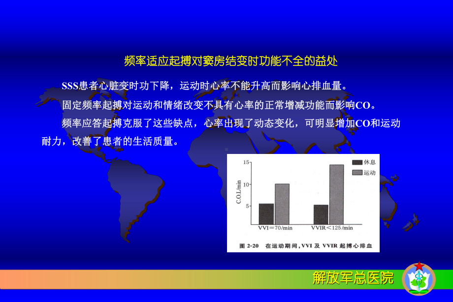 频率适应性起搏器的临床应用课件.pptx_第2页