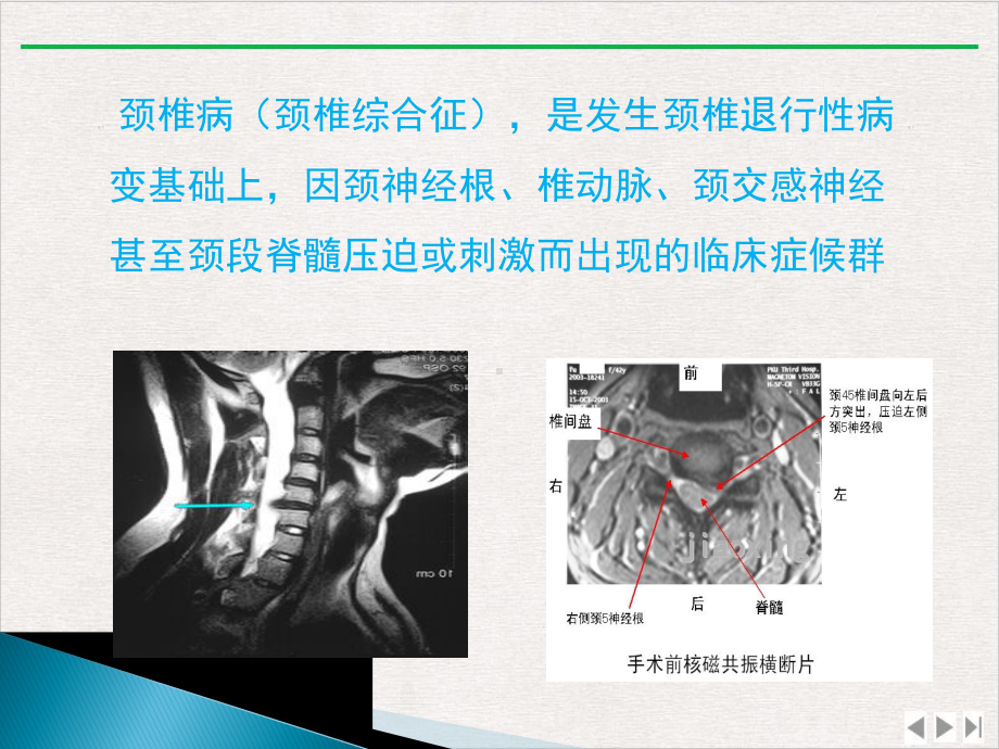 颈椎腰椎病科普讲座版课件.pptx_第2页