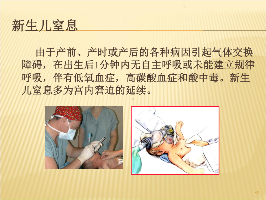 新生儿窒息的抢救课件.ppt_第2页