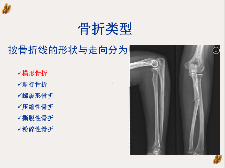 骨骼与关节损伤培训课件.pptx_第3页