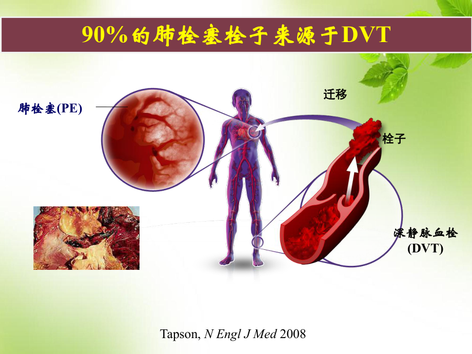 骨科大手术后VTE预防—国内外指南更新-课件.ppt_第3页